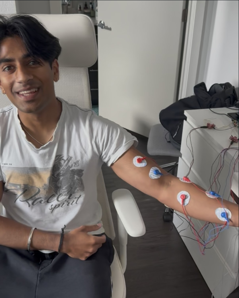 Me with the EMG muscle sensors attached to my arm.